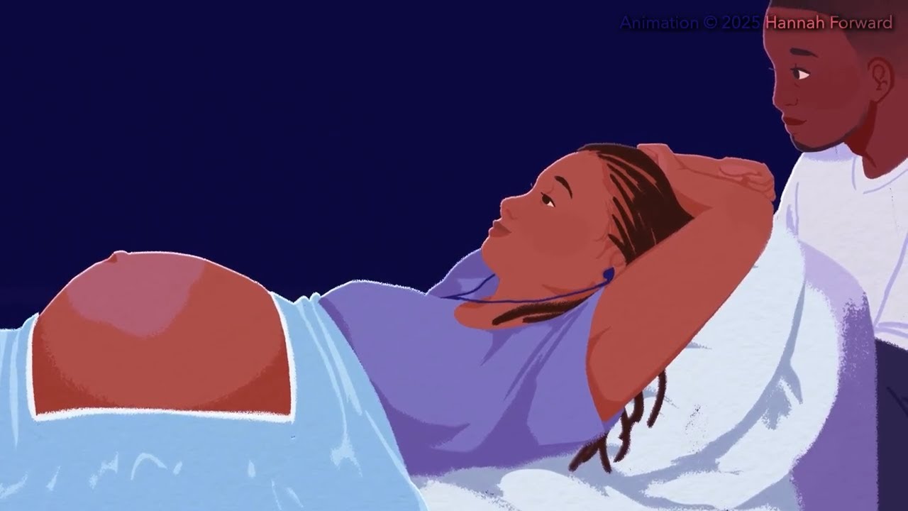 A video on intrauterine blood transfusions from Johns Hopkins Medicine