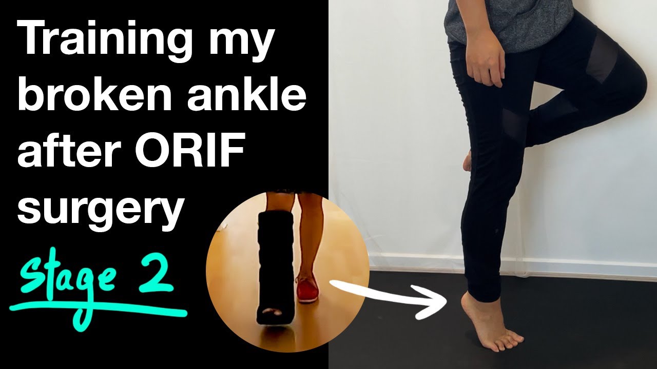 Training my broken ankle after ORIF surgery stage 2 YouTube