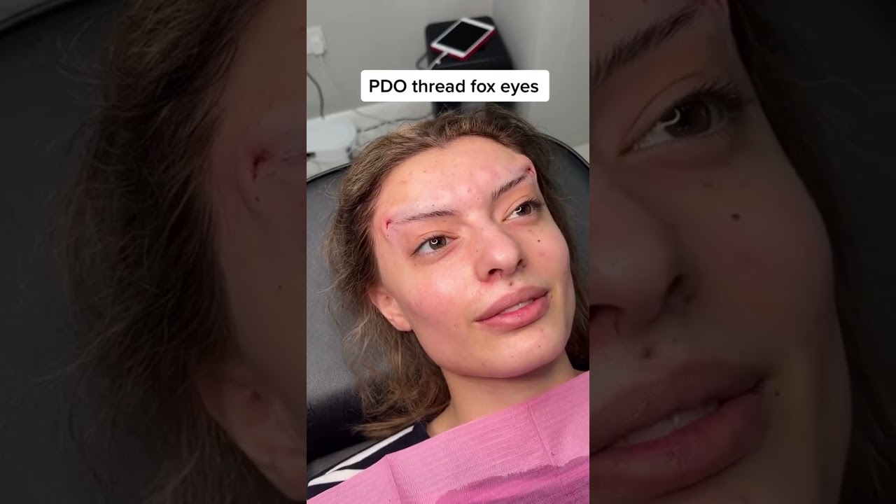 PDO thread fox eyes 