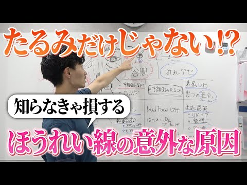 【保存版】もう悩まない!ほうれい線の原因と治療法を医師が徹底解説!