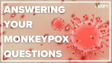 Your monkeypox questions answered