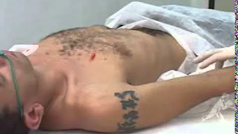 O que é drenagem da cavidade pleural?