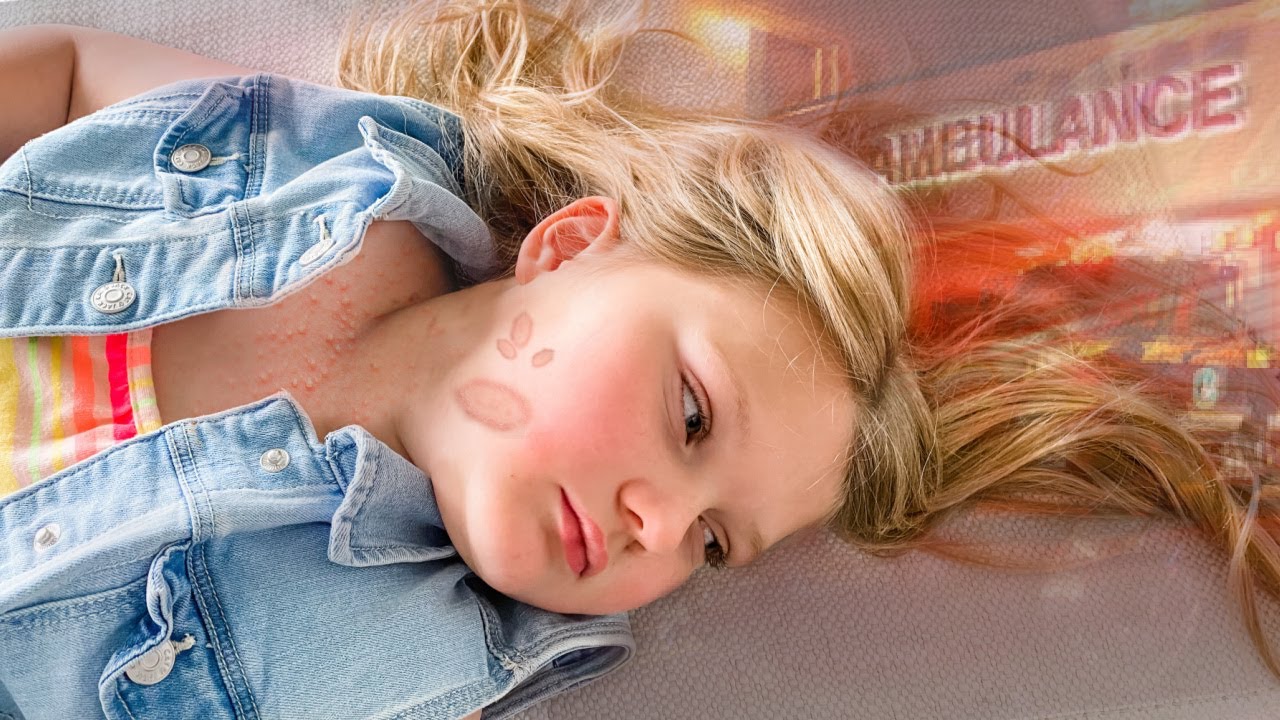 Ужасная сыпь и визит в больницу!