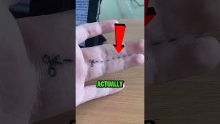 He Was Born With Fused Fingers Then His Girlfriend Did This😱