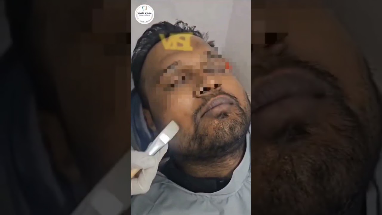 "Transform your skin with pigmentation treatment for a brighter glow!"