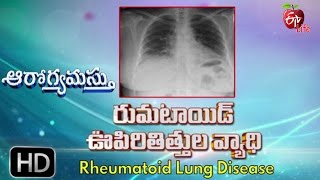 Aarogyamastu | Rheumatoid Lung Disease | 27th April 2017 | ఆరోగ్యమస్తు