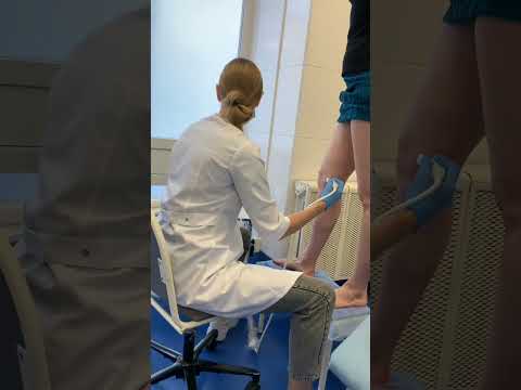 #лечениеварикоза #флебологмосква #флеболог #шортс #варикоз_как_избавиться #полезности #допосле