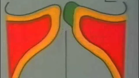 Vocal Cord Vibration - Minoru Hirano, MD