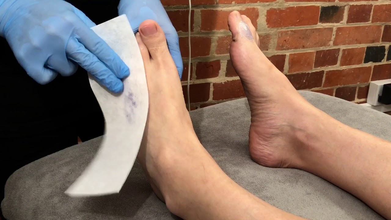 Waxing toe hair with hot wax : male waxing demo