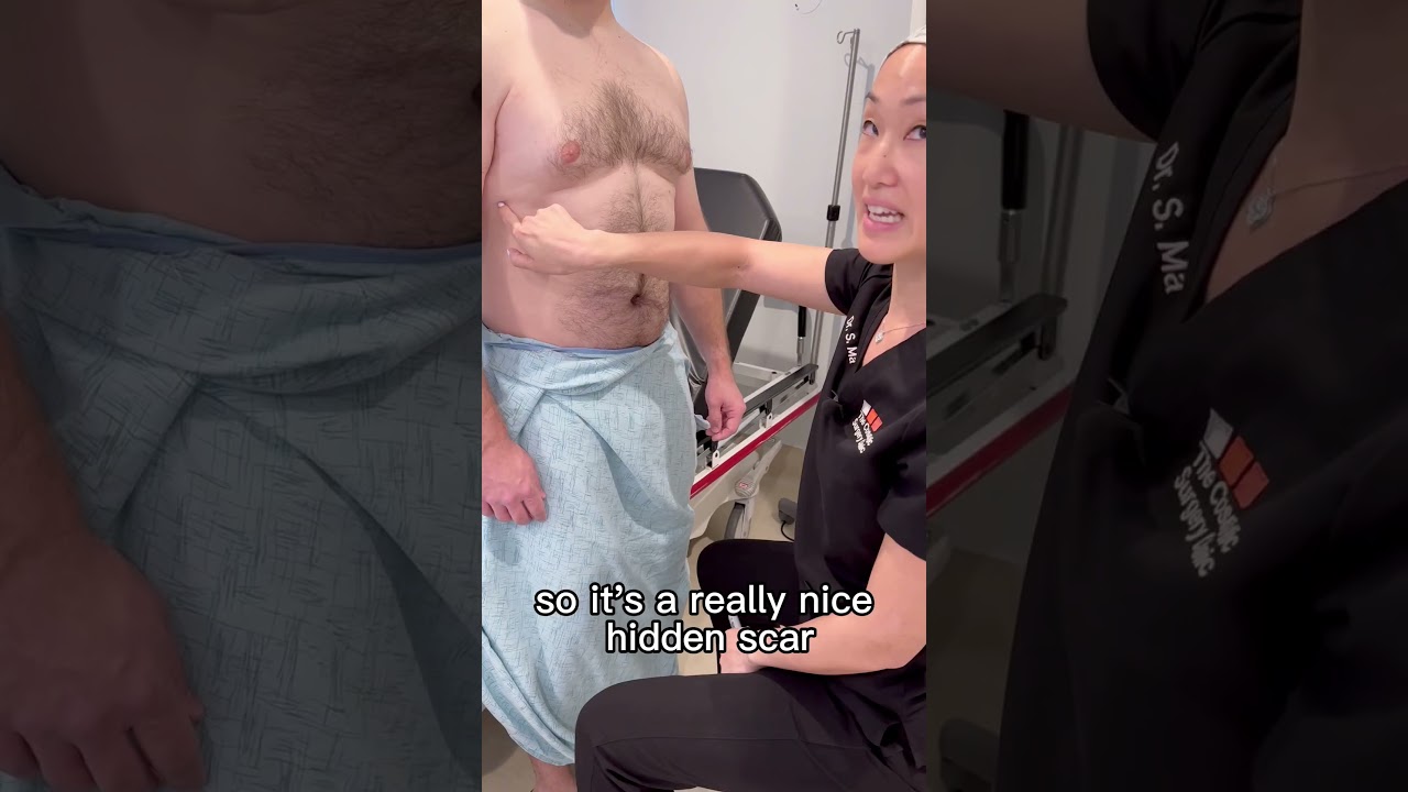 Gynecomastia Patient Consultation Part 1: Patient’s Story & Dr. Ma’s Scar-Minimizing Approach