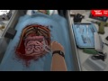 Beginning of video