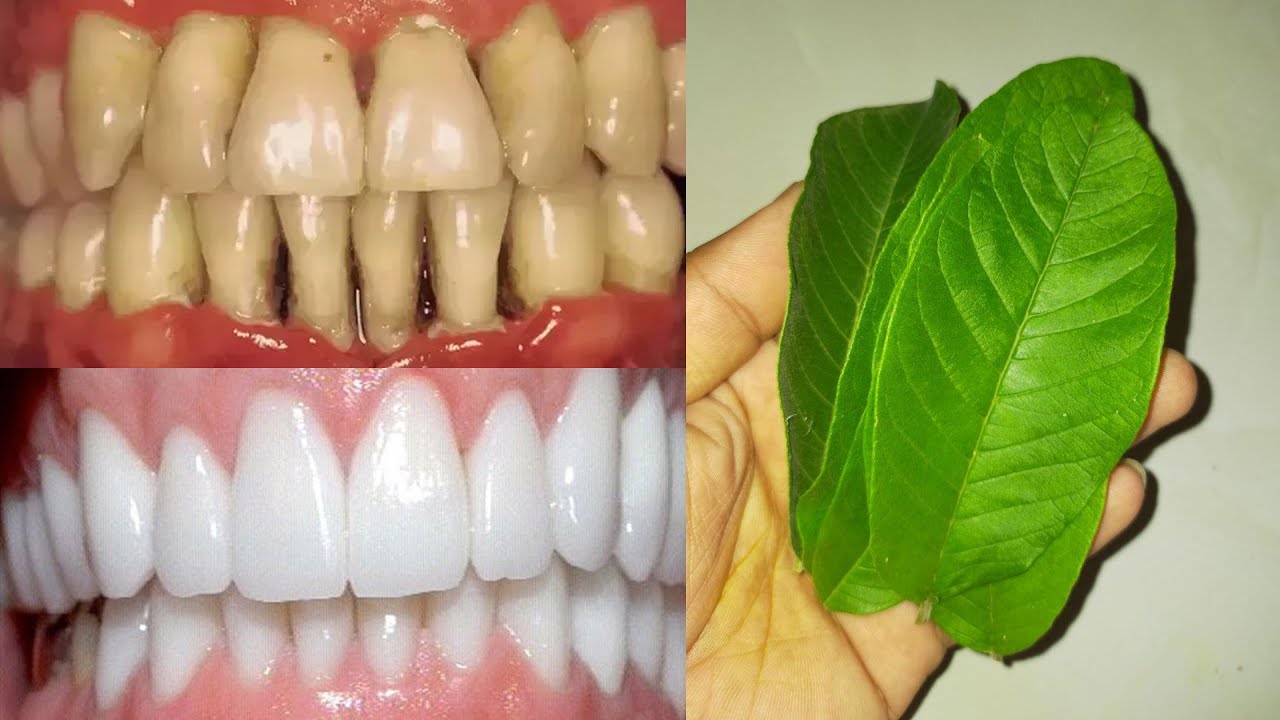Guava leaves for teeth whitening How to teeth whitening at home in 1