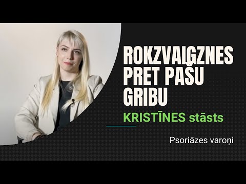 ES MĀCOS SADZĪVOT AR PSORIĀZI - KRISTĪNES STĀSTS