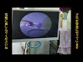 ASMR耳掃除 この深いクリーニングを見逃すと後悔します ASMR耳掃除 この深いクリーニングを見逃すと後悔します