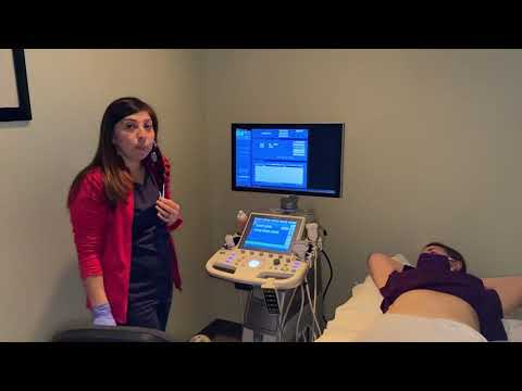 Video: Ujian Semasa Kehamilan: Ultrasound Abdomen