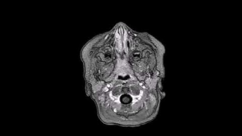 Brain Scan: +C AX sT1W 3D TFE