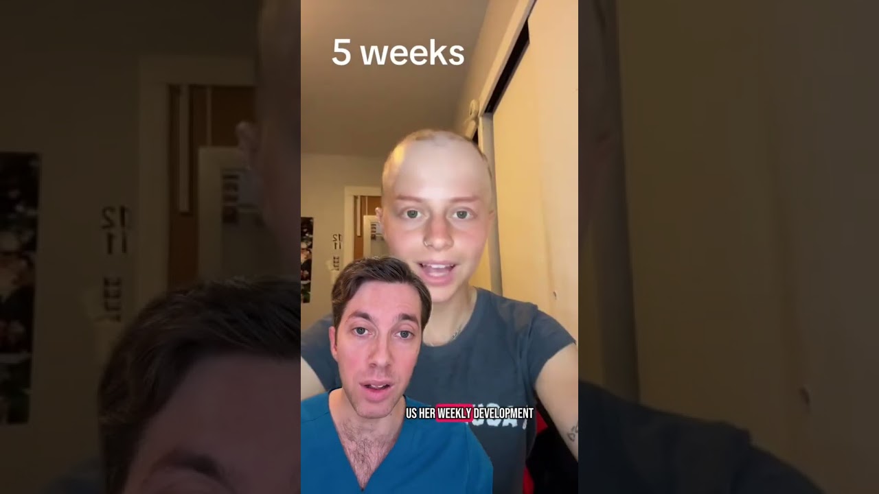Breakthrough Treatment for Alopecia Areata: Olumiant