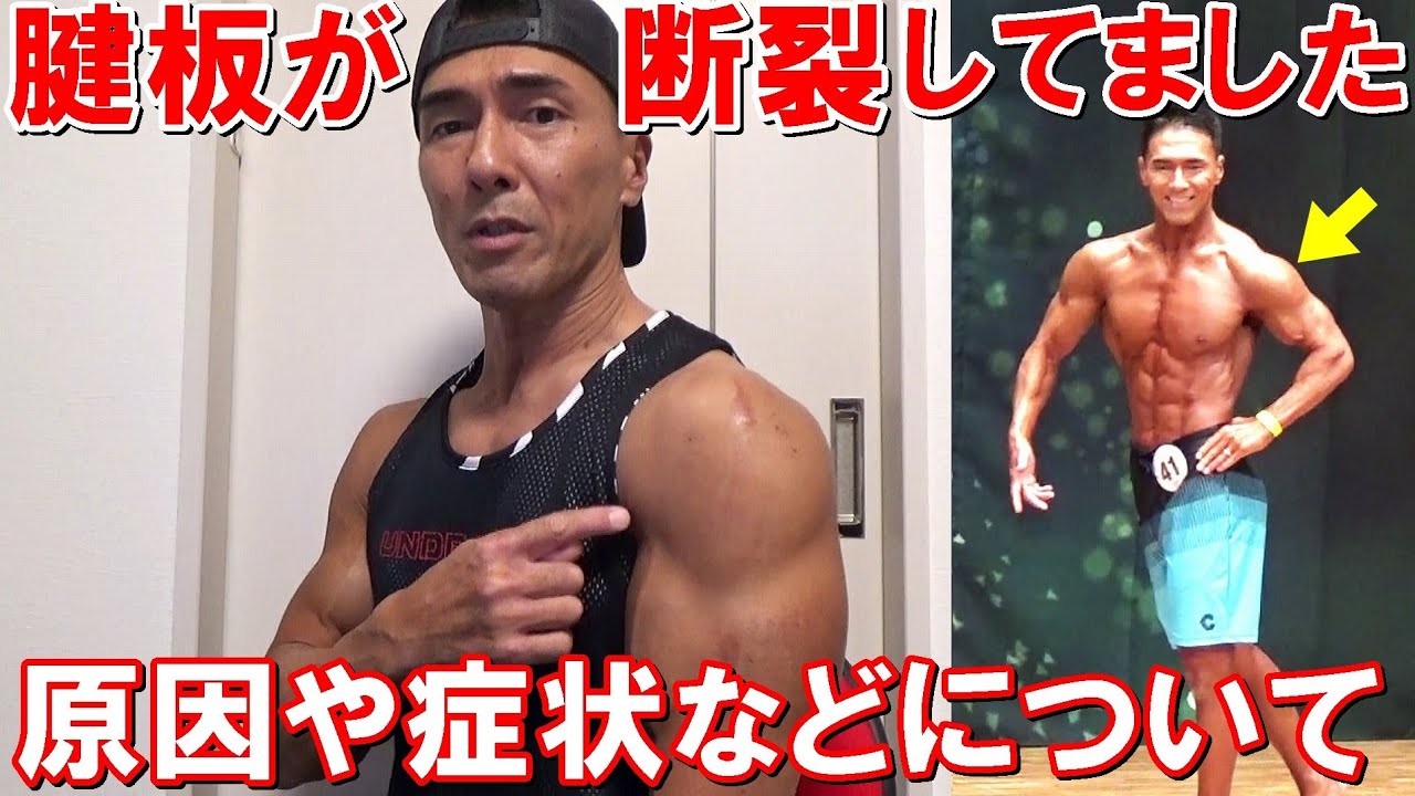 【ご報告】左肩の腱板が断裂してました。原因や症状、治療やトレーニングの計画などについて