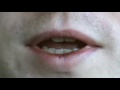 Visual contribution to speech perception - "lipreading"