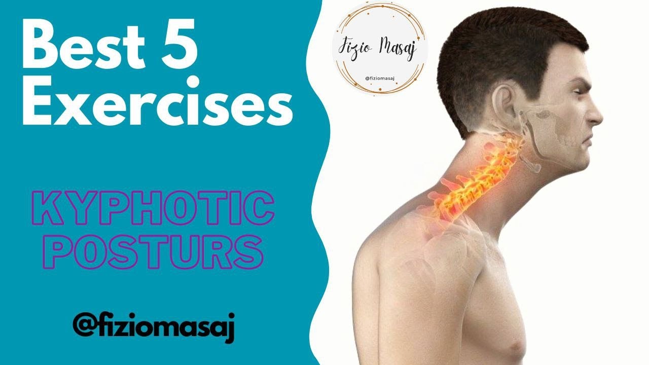 Best 5 exercise for kyphotic, forwarded head and rounded shoulders Posture (fiziomasaj) YouTube