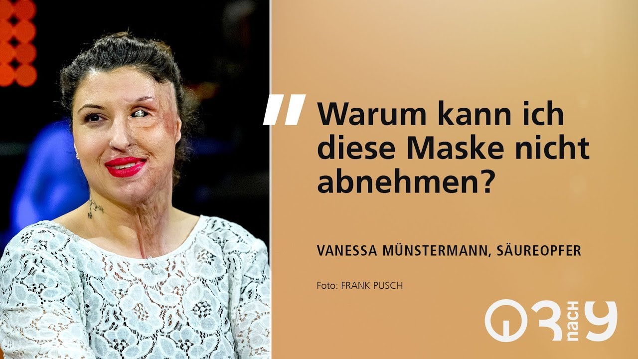 Sie überlebte einen Femizid: Vanessa Münstermann, Opfer eines Säure-Anschlags ihre Ex-Freundes