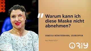 Vanessa Münstermann darüber, wie sie sich nach dem Säure-Attentat zurück ins Leben kämpfte // 3nach9