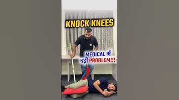 Airforce Medical Knock Knees Problem | Knock Knees in Airforce Medical | Airforce Medical Points