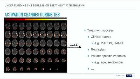 OHBM 2025 | Educational Course | How to Use MRI to Optimize Brain Stimulation | Part 5