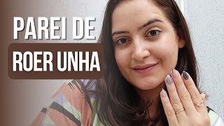 COMO CONSEGUI PARAR DE ROER UNHA!! VENCI O VÍCIO DE ROER UNHA AOS 29 ANOS!