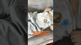 What Is the Purpose of Ostomy Support Belt