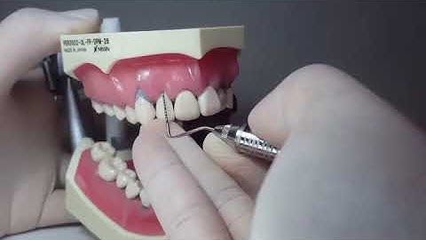 Probing on a Perio Typodont