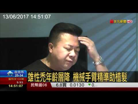 董至成植髮 非凡新聞 Youtube