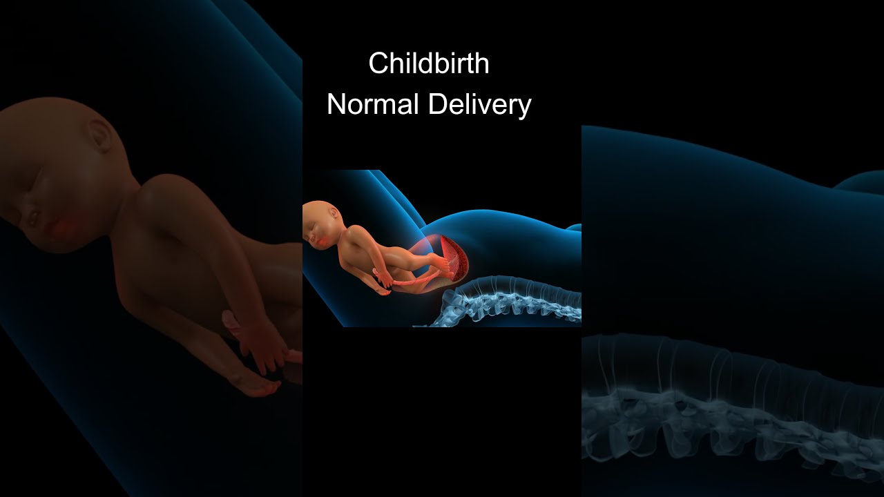 Childbirth Normal Delivery BabyBorn Dr Dipti Jain Advance Hospital Ahmedabad YoutubeShorts