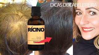 NASCE CABELO ATÉ ONDE NÃO TEM CRESCE RÁPIDO E PARA DE CAIR #HairTutorial