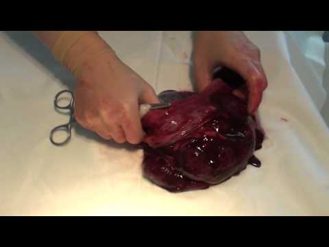 Placenta Full HD Istukka