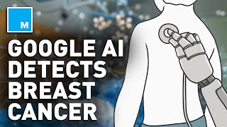 How Google AI Can Detect Breast Cancer | Mashable News