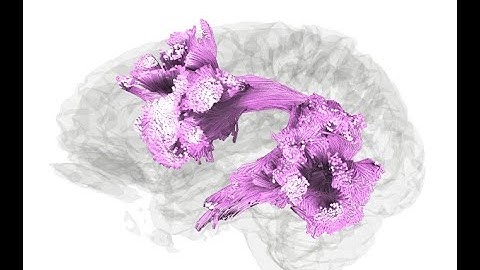 Automatic fiber tracking using DSI Studio