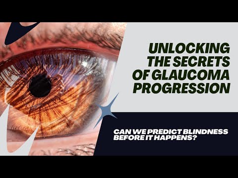 Glaucoma Progression Prediction Using Longitudinal Data | Capstone Project| Code + explanation #aiml