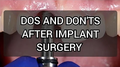 Dos and don'ts after dental implant surgery. 10 simple measures to take.