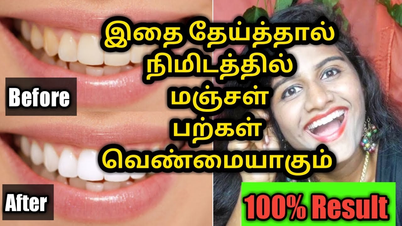 How to whiten teeth at home in Tamil/மஞ்சள் பற்கள் வெண்மையாக இதை தேய்த்தால் போதும்... YouTube