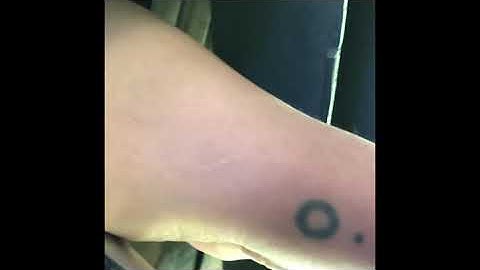 Code P0156 Ford Truck