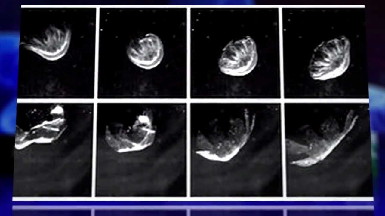 Amazing Artificial Jellyfish Made From Rat Hearts Can Propel Itself