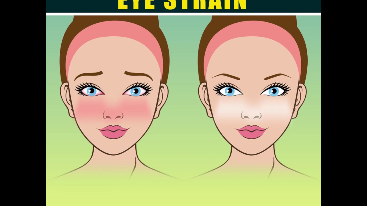 How To Reduce Eye Strain YouTube