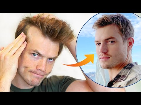 Video: När börjar hårfästena avta?
