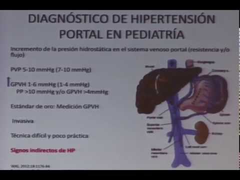 Colaterales perisplénicas hipertensión portal