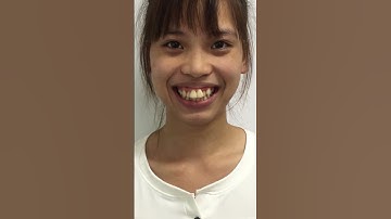 Như hai người khác nhau || Dr.Trịnh Đức Mậu || Nha Khoa Quốc Tế Việt Đức