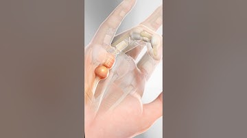 Trigger Finger (3D Animation)