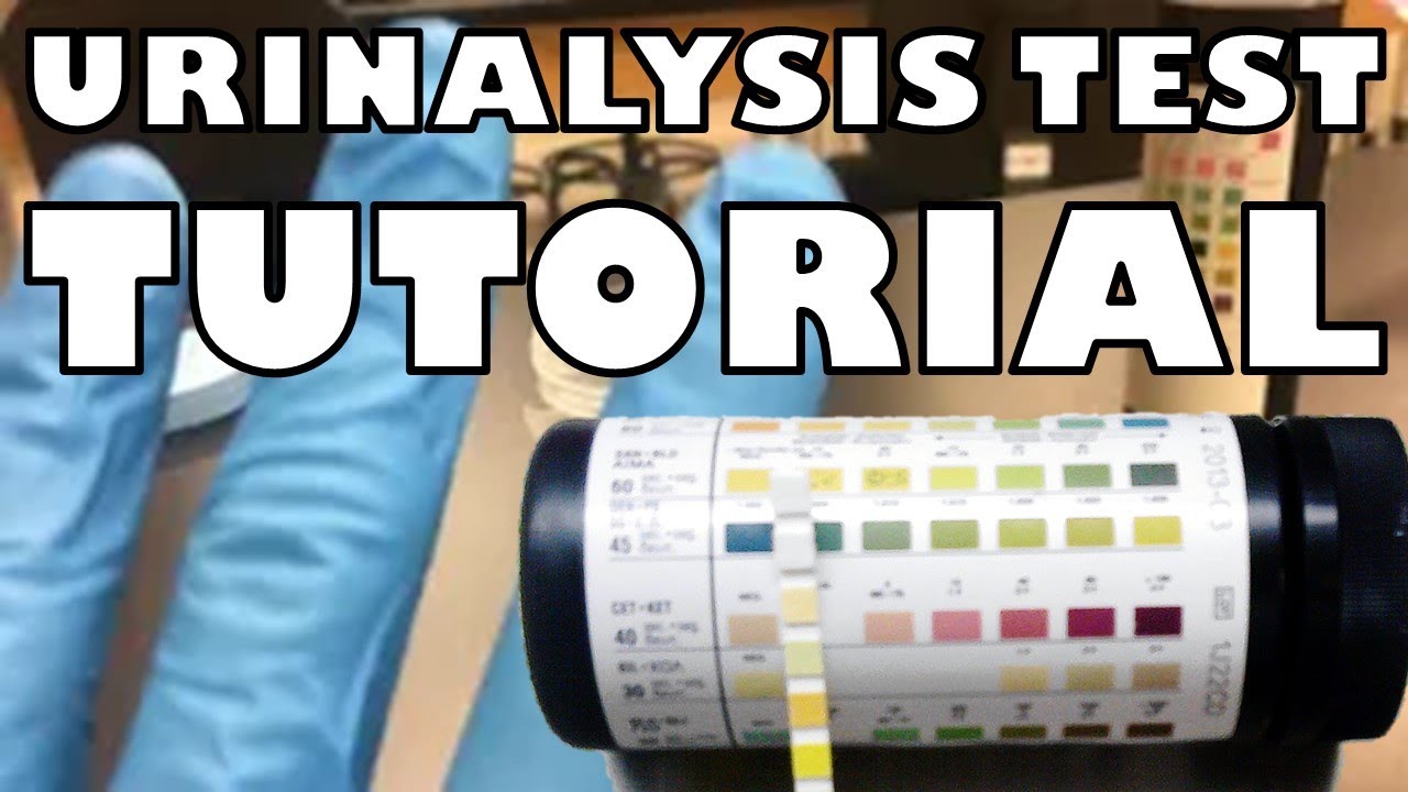 case study about urinalysis with discussion