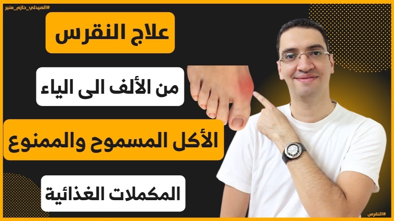 علاج النقرس بدون أدوية وبالأدوية - الأكل المسموح والممنوع لمريض النقرس