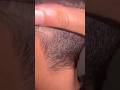 Hairl growing massage #hairgrowth #haircare #haircut #asmr#ingrownhairremoval #removeingrown